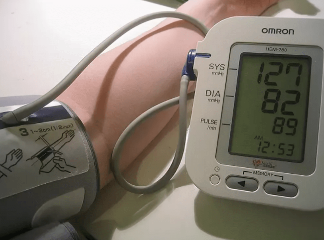 pressure readings stabilized after receiving Cardione